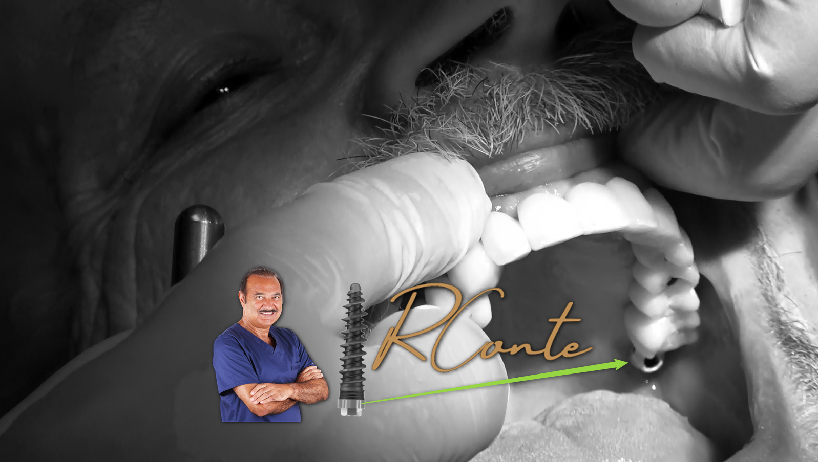 Dental Implant Cost North DeLand