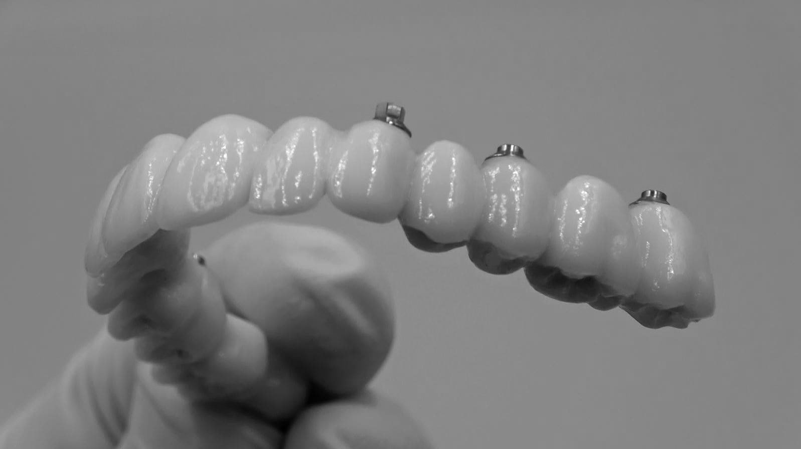 Dental Implant Cost Fort Worth